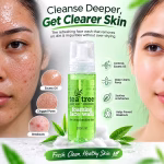 Xpel Tea Tree Foaming Face Wash